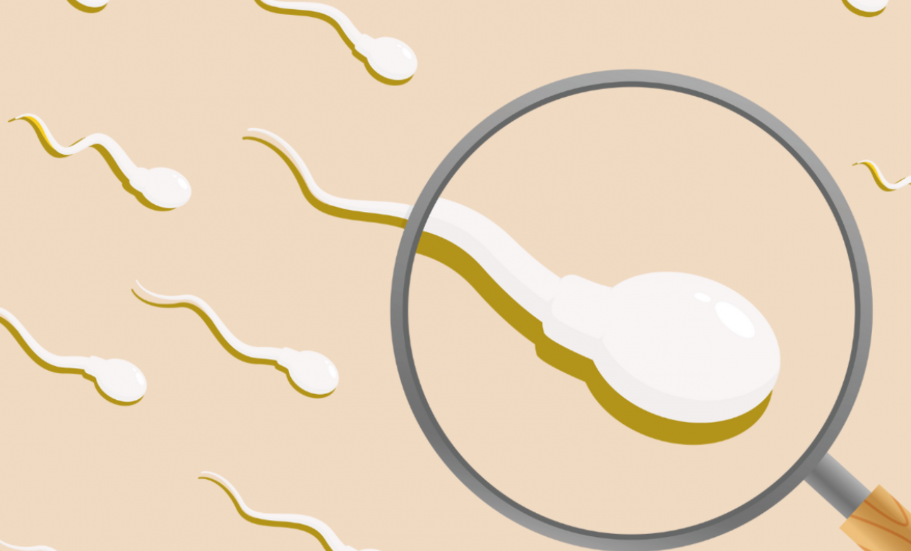 Grafik von schwimmenden Spermien