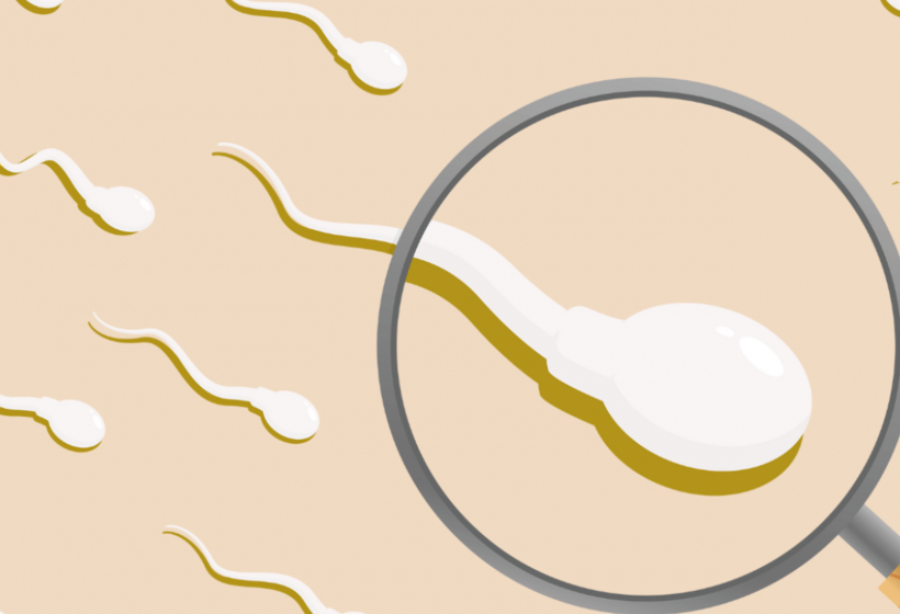 Grafik von schwimmenden Spermien