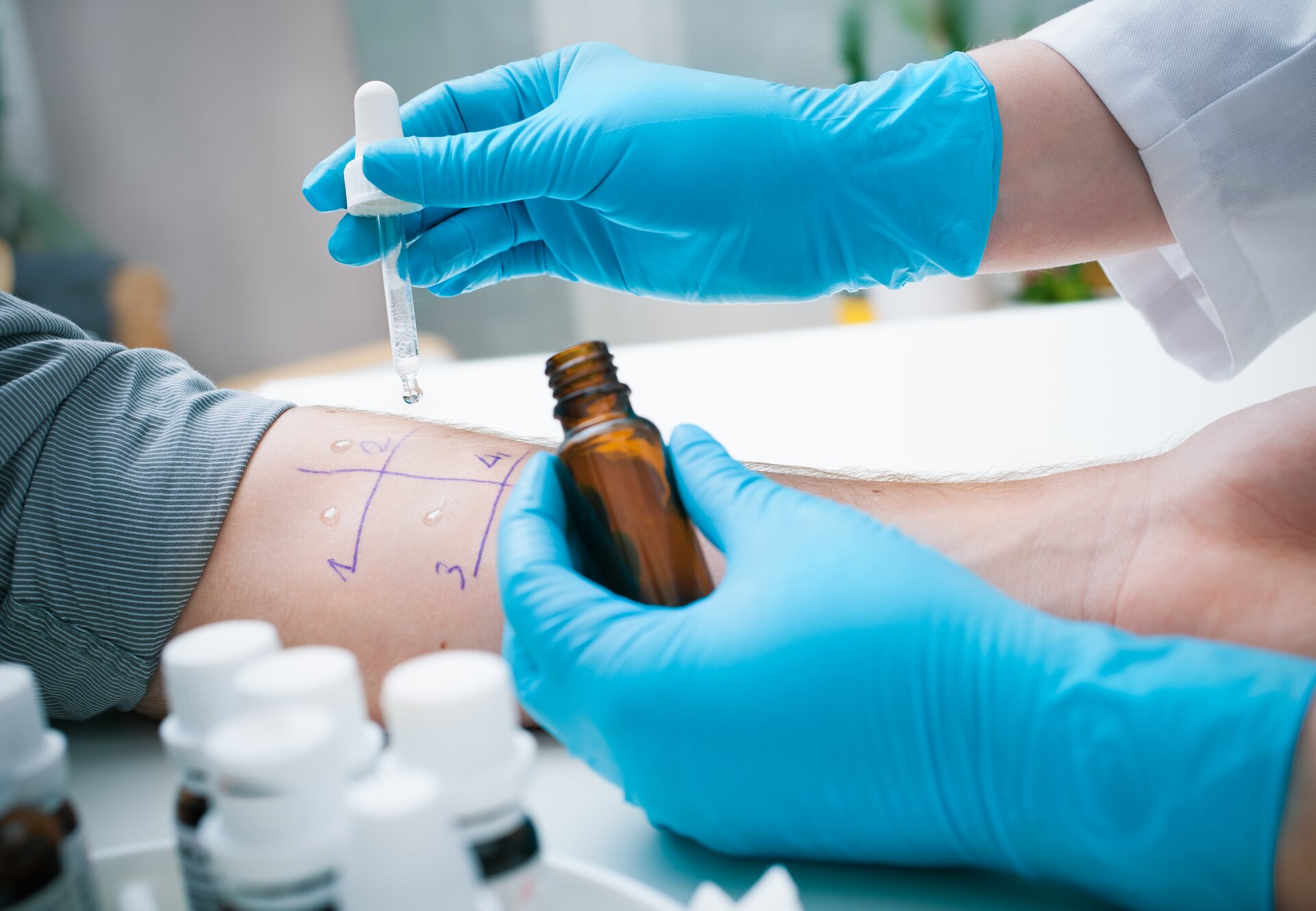 Hier zeigt sich, worauf die Haut empfindlich reagiert – jeder Tropfen steht für ein mögliches Allergen. Hier zeigt sich, worauf die Haut empfindlich reagiert – jeder Tropfen steht für ein mögliches Allergen.