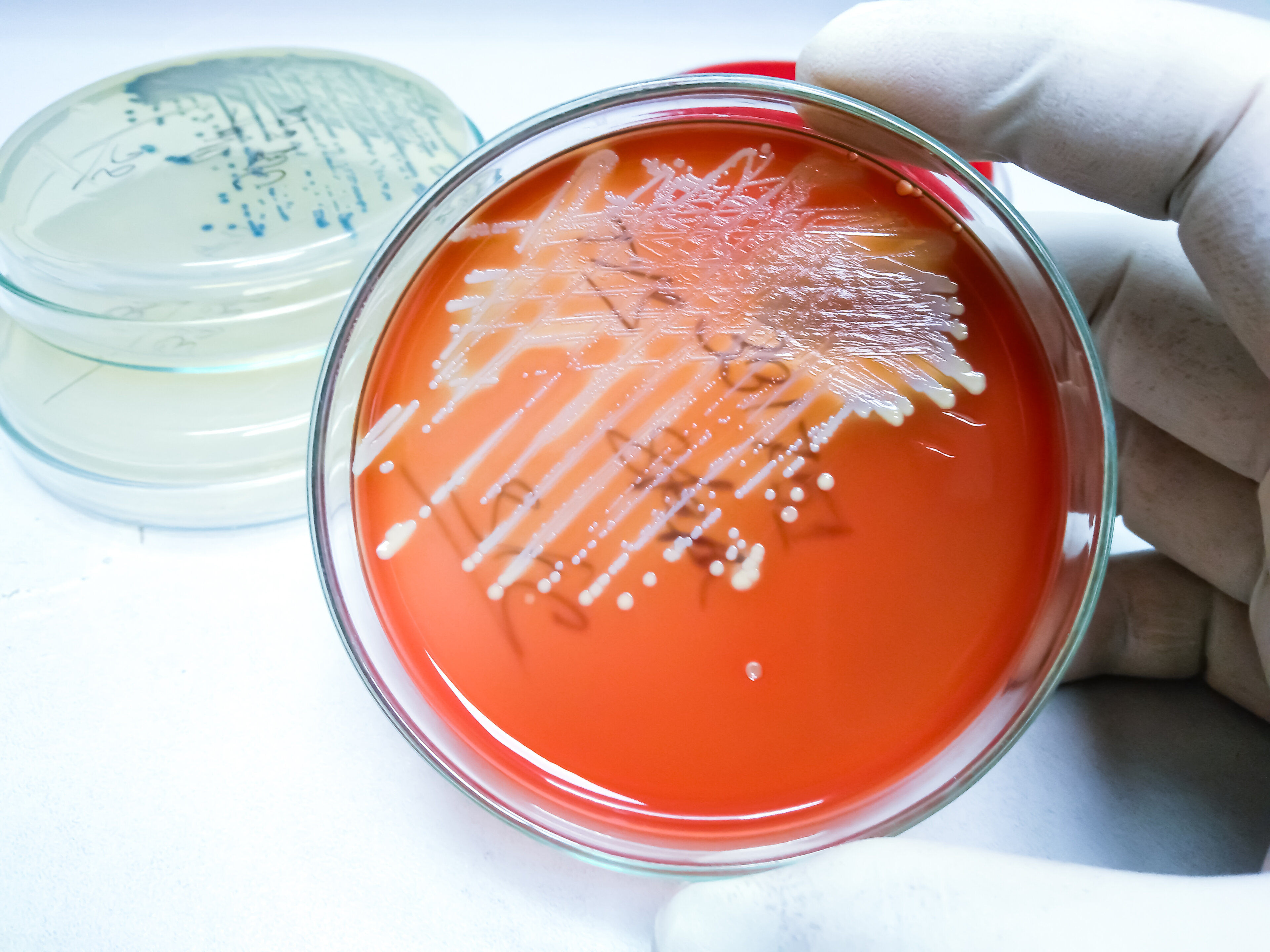 Staphylococcus-aureus-Bakterienkultur.